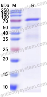 Recombinant ZIKV NS3/Serine protease NS3 Protein, N-His