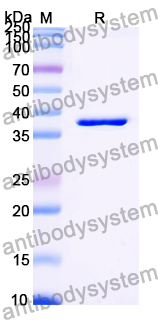 Recombinant LSDV G-protein-coupled chemokine like receptor/LSDV011 Protein, N-GST & C-His