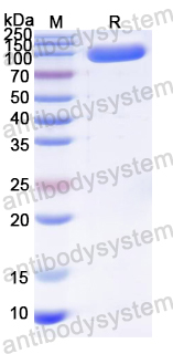 Recombinant Porcine parvovirus/PPV Capsid protein VP2 Protein, N-His