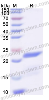 Recombinant RD114 retrovirus env/Envelope glycoprotein Protein, N-His