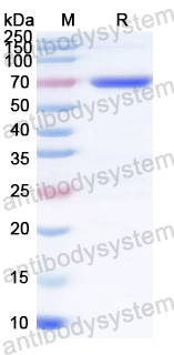 Recombinant HCMV/HHV-5 UL123/IE1 Protein, N-GST & C-His