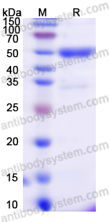 Recombinant BCCV N/Nucleoprotein Protein, N-His