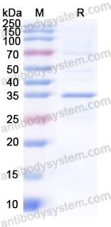 Recombinant EBV/HHV-4 BZLF1 Protein, N-GST & C-His