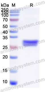 Recombinant SFTSV NP/Nucleoprotein Protein, N-His