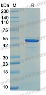 Recombinant CHPV N/Nucleoprotein Protein, N-His