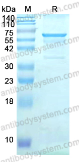 Recombinant ASFV B602L Protein, C-His