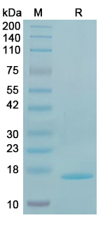 Recombinant HTNV N/Nucleoprotein Protein, N-His