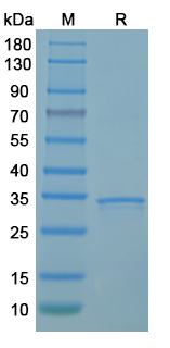 Recombinant MPXV/MPOX A17L Protein, C-His