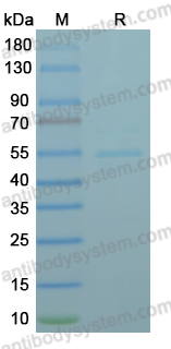 SDS-PAGE for Recombinant LSDV D3R Protein, N-GST & C-His ?>