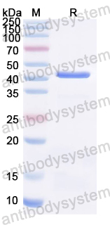 Recombinant Tupaia chinensis CD4 Protein, N-His