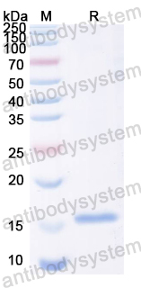 Recombinant Tupaia chinensis CD8A Protein, N-His