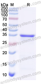 Recombinant Hamadryas baboon Uricase/Uox Protein, N-His