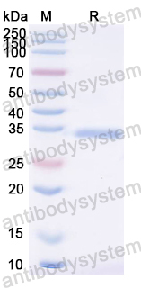 Recombinant Zebrafish Uricase/Uox Protein, N-His