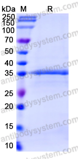 Recombinant Clostridioides difficile Toxin B/tcdB Protein, N-His