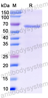 Recombinant Clostridium novyi Toxin A/tcdA Protein, N-His