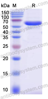 Recombinant Clostridium perfringens pfo/Perfringolysin O/Theta-toxin Protein, N-His