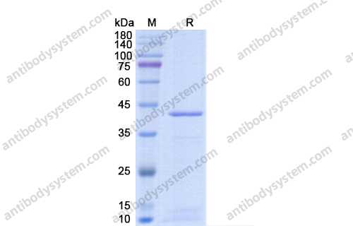 Recombinant Chlamydia psittaci Porin/MOMP Protein, N-His