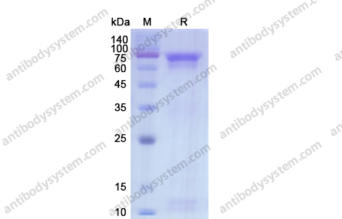 Recombinant Chlamydia psittaci dnaK/HSP70 Protein, N-His