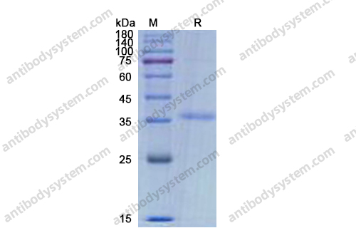 Recombinant Pyrococcus horikoshii cutA Protein, N-His