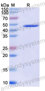 Recombinant Helicobacter pylori HP_1019/Periplasmic serine endoprotease DegP-like Protein, C-His