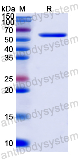 Recombinant Corynephage omega DT/Diphtheria toxin Protein, C-Strep