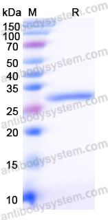 Recombinant Vibrio cholerae serotype O1 ctxB/Cholera Toxin Subunit B Protein, N-His-SUMO