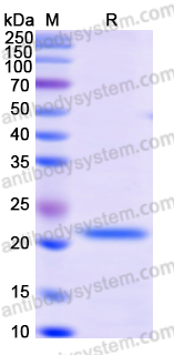 Recombinant Treponema pallidum/TP TPF1/Antigen 4D Protein, C-His