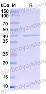 Recombinant Treponema pallidum/TP TPP17/17 kDa lipoprotein Protein, N-GST