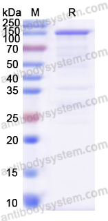 Recombinant Treponema pallidum/TP TPP15 & tmpA & TPP47 Protein, C-His