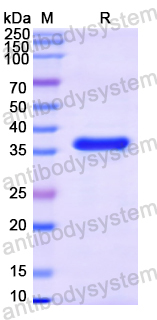 Recombinant Treponema pallidum/TP tmpA Protein, C-His