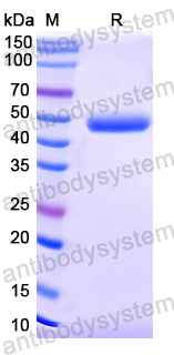 Recombinant Treponema pallidum/TP TPP47 Protein, C-His