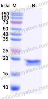 Recombinant Staphylococcus aureus srtA/Sortase A Protein, C-His