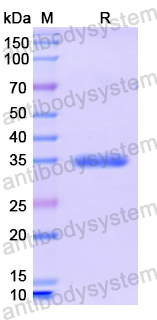 Recombinant Cutibacterium acnes PPA2105/Triacylglycerol lipase Protein, N-MAT