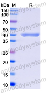 Recombinant Mycoplasma pneumoniae mgpA/Adhesin P1 Protein, N-His