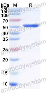 Recombinant Mycoplasma pneumoniae mgpA/Adhesin P1 Protein, N-His