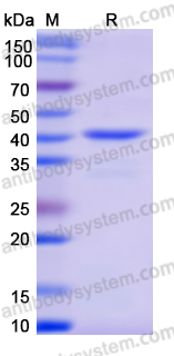 Neuraminidase (Sialidase)