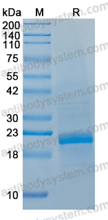 Recombinant Porphyromonas gingivalis kgp/prtK Protein, C-His