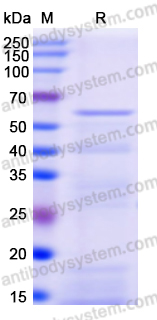 Recombinant Porphyromonas gingivalis rgpB/Gingipain R2 Protein, N-His