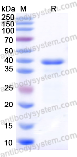 Recombinant Staphylococcus aureus lukF-PV Protein, N-His