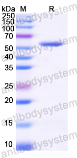 Recombinant Vibrio cholerae serotype O1 DnaA Protein, C-His