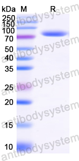 Recombinant Vibrio cholerae serotype O1 RctB Protein, N-His