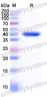 Recombinant Staphylococcus aureus WalK Protein, N-GST