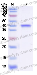 Recombinant Yersinia enterocolitica Invasin Protein, N-His-SUMO