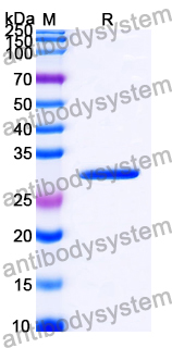 Recombinant Yersinia enterocolitica OsmY Protein, N-His-SUMO