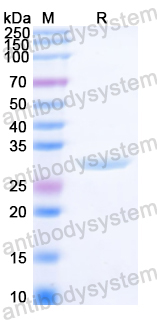 Recombinant Clostridium perfringens cpb2/Beta2-toxin Protein, N-His