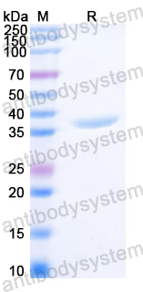 Recombinant Clostridium perfringens cpb/Beta-toxin Protein, N-His