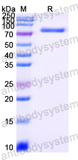 Recombinant Streptococcus pseudoporcinus IgdE2 Protein, N-GST & C-His