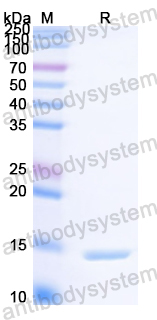 Recombinant Streptococcus pyogenes M protein Protein, N-His