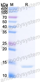 Recombinant Streptococcus pyogenes M protein Protein, N-His