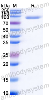 Recombinant Streptococcus suis ssnA Protein, N-His
